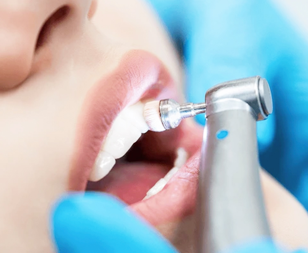 Brentwood Dental Care Professional Dental Cleaning in Bay Shore NY