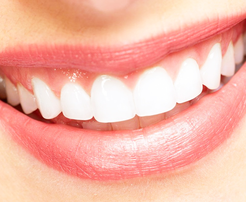 Brentwood Dental Care Professional Teeth Whitening in Bay Shore NY